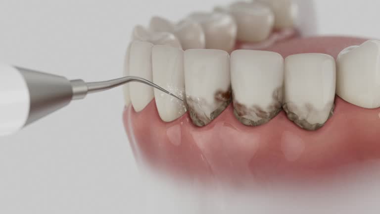 Reliable Tooth Extraction contractor in Cocke County County, TN by Dentist Open Now